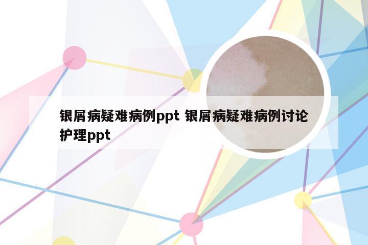 银屑病疑难病例ppt 银屑病疑难病例讨论护理ppt