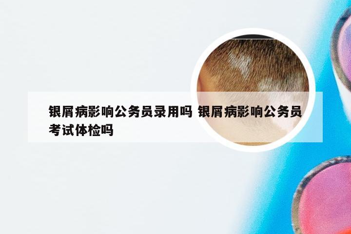 银屑病影响公务员录用吗 银屑病影响公务员考试体检吗