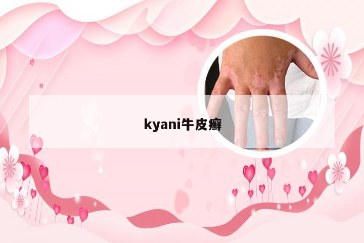 kyani牛皮癣