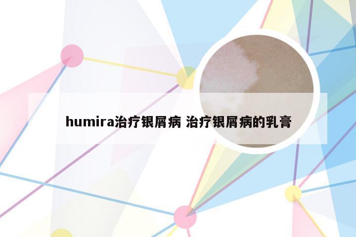 humira治疗银屑病 治疗银屑病的乳膏