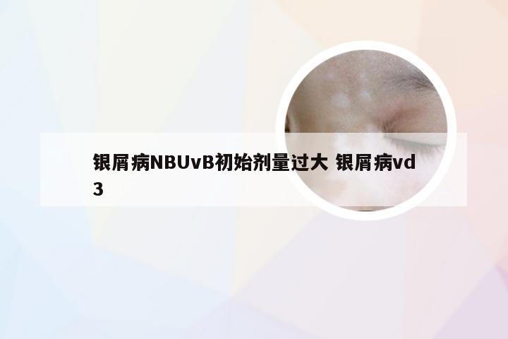 银屑病NBUvB初始剂量过大 银屑病vd3