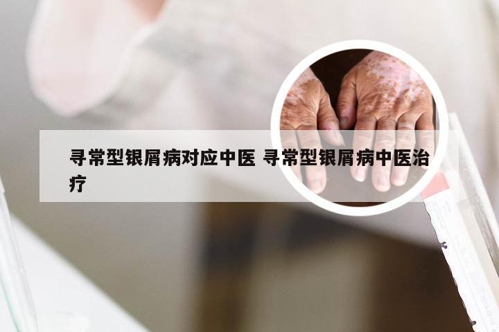 寻常型银屑病对应中医 寻常型银屑病中医治疗