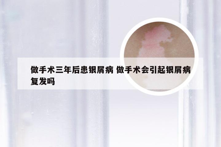 做手术三年后患银屑病 做手术会引起银屑病复发吗