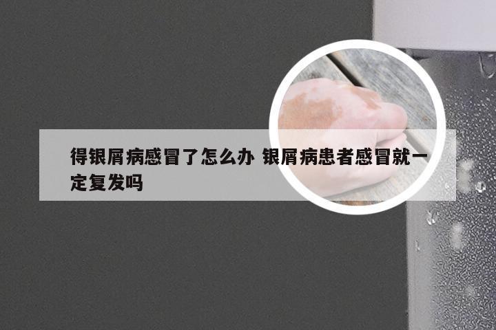 得银屑病感冒了怎么办 银屑病患者感冒就一定复发吗