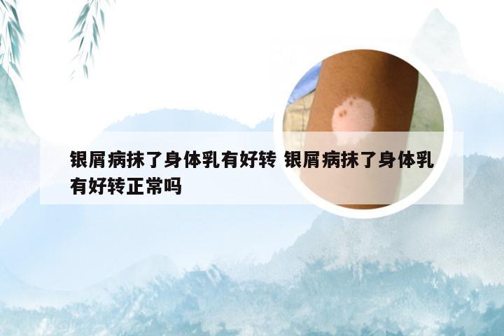 银屑病抹了身体乳有好转 银屑病抹了身体乳有好转正常吗