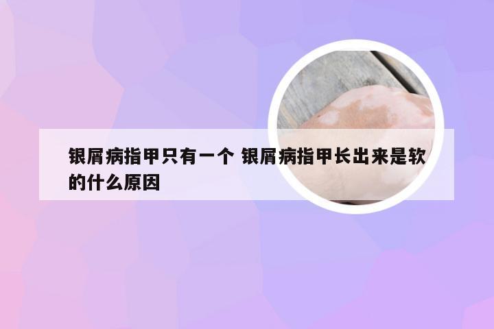 银屑病指甲只有一个 银屑病指甲长出来是软的什么原因