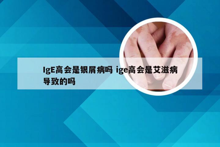 IgE高会是银屑病吗 ige高会是艾滋病导致的吗