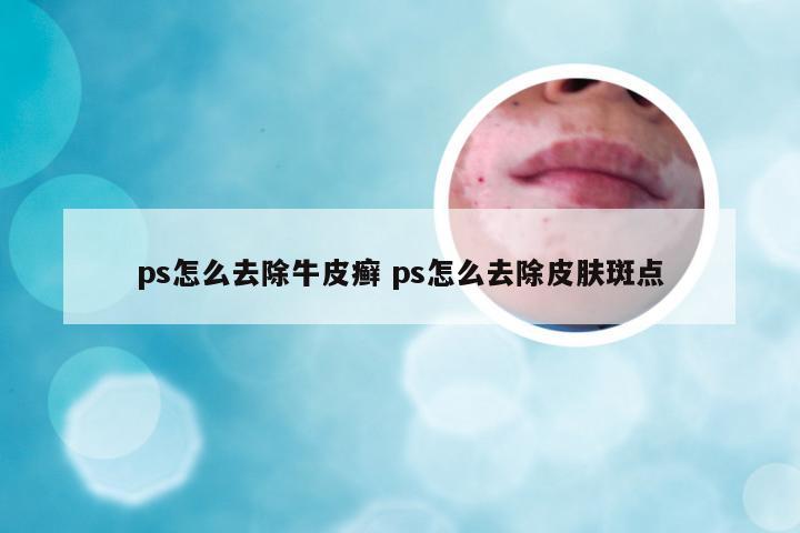 ps怎么去除牛皮癣 ps怎么去除皮肤斑点