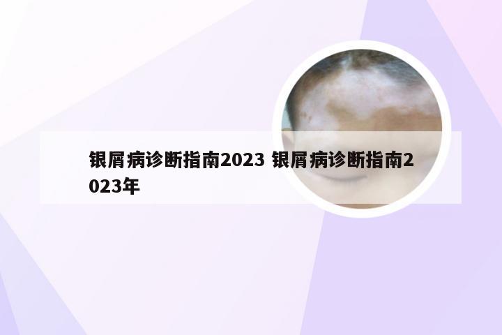 银屑病诊断指南2023 银屑病诊断指南2023年