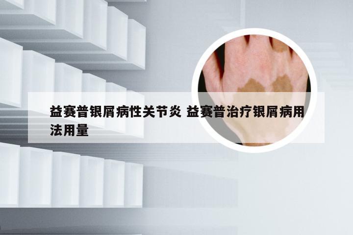 益赛普银屑病性关节炎 益赛普治疗银屑病用法用量