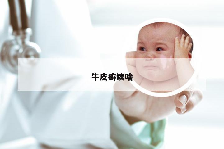 牛皮癣读啥