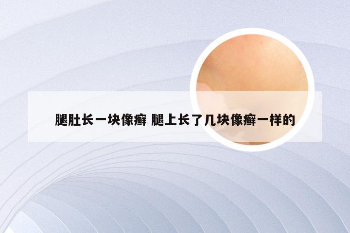 腿肚长一块像癣 腿上长了几块像癣一样的