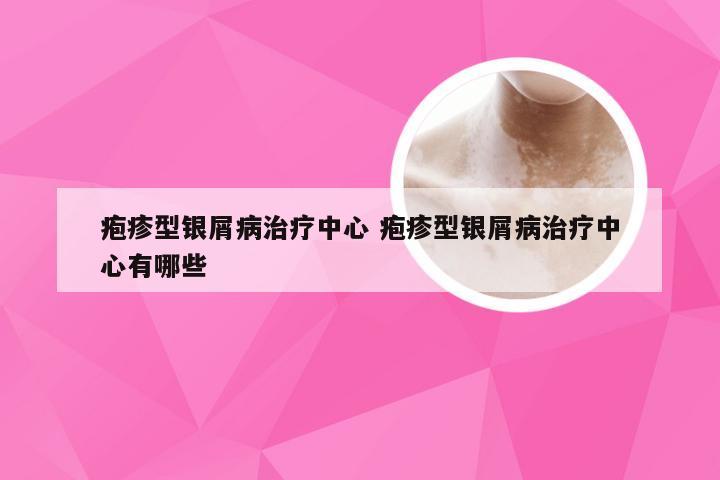 疱疹型银屑病治疗中心 疱疹型银屑病治疗中心有哪些