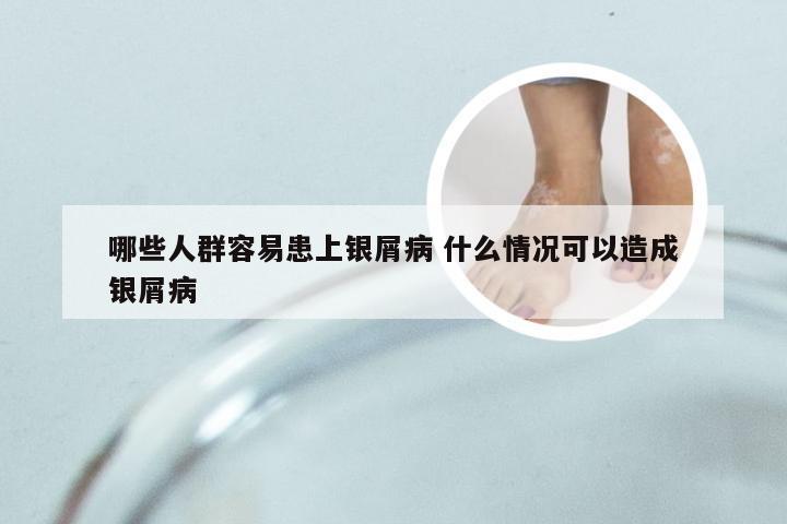 哪些人群容易患上银屑病 什么情况可以造成银屑病