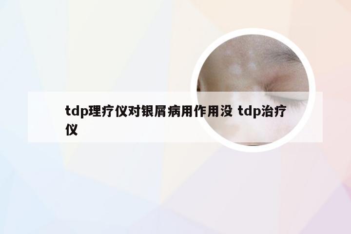 tdp理疗仪对银屑病用作用没 tdp治疗仪