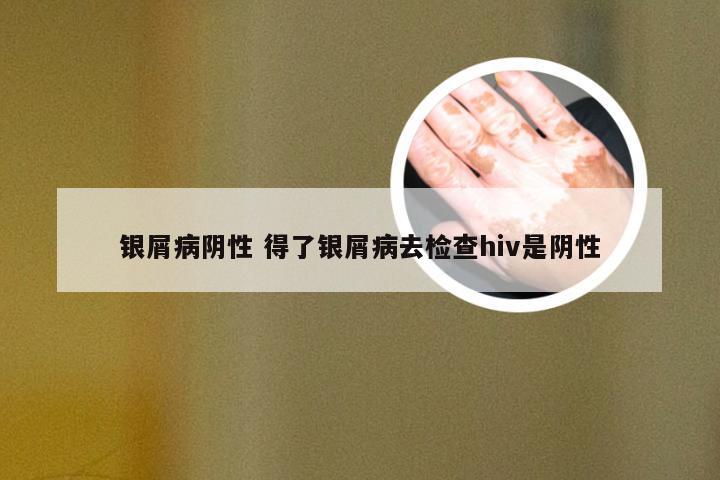 银屑病阴性 得了银屑病去检查hiv是阴性