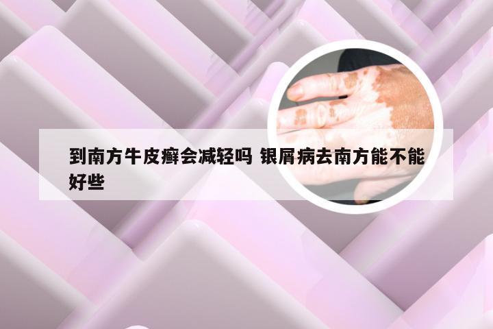 到南方牛皮癣会减轻吗 银屑病去南方能不能好些