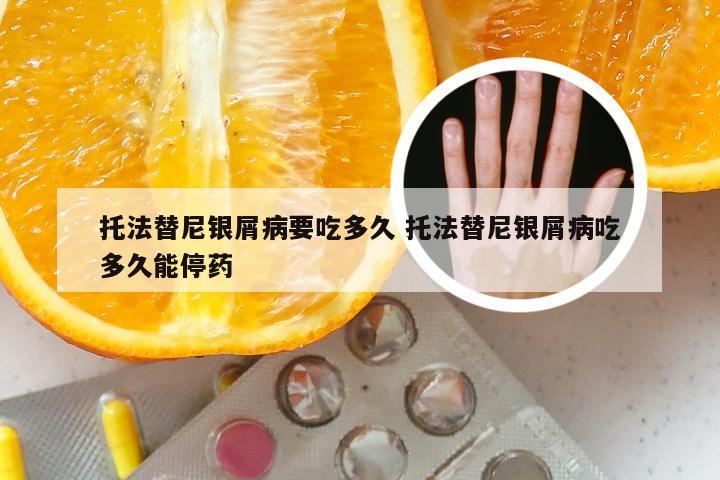 托法替尼银屑病要吃多久 托法替尼银屑病吃多久能停药