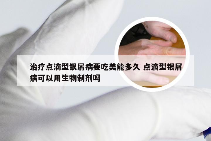 治疗点滴型银屑病要吃美能多久 点滴型银屑病可以用生物制剂吗