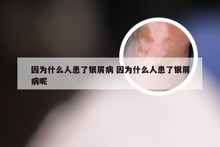 因为什么人患了银屑病 因为什么人患了银屑病呢