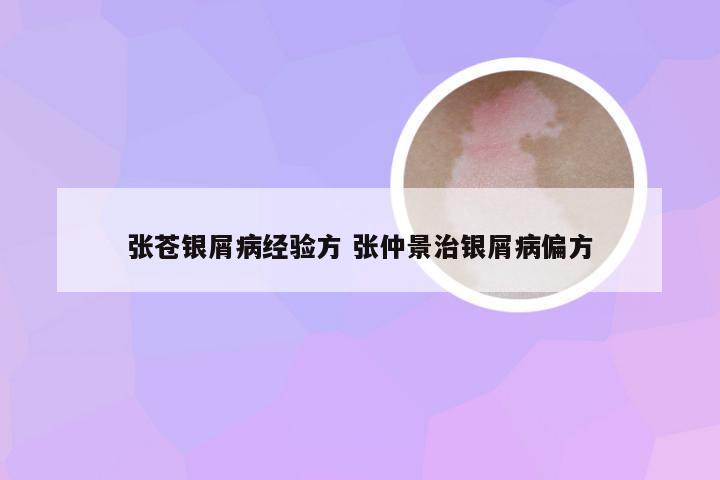 张苍银屑病经验方 张仲景治银屑病偏方