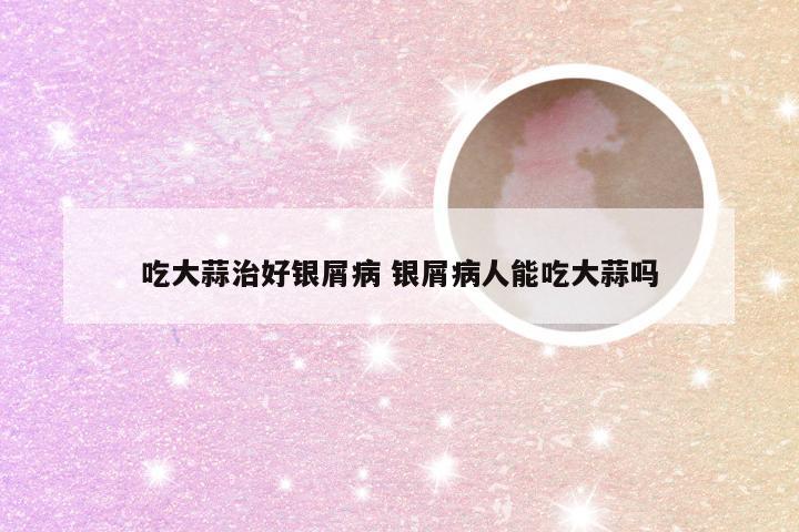 吃大蒜治好银屑病 银屑病人能吃大蒜吗