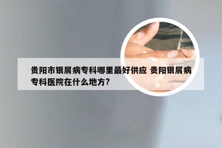 贵阳市银屑病专科哪里最好供应 贵阳银屑病专科医院在什么地方?