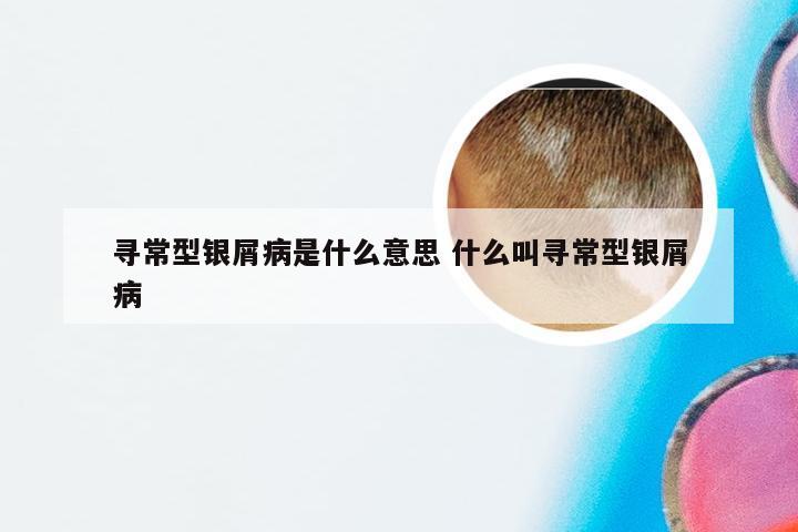 寻常型银屑病是什么意思 什么叫寻常型银屑病