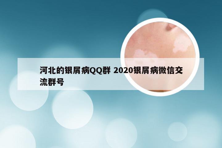 河北的银屑病QQ群 2020银屑病微信交流群号