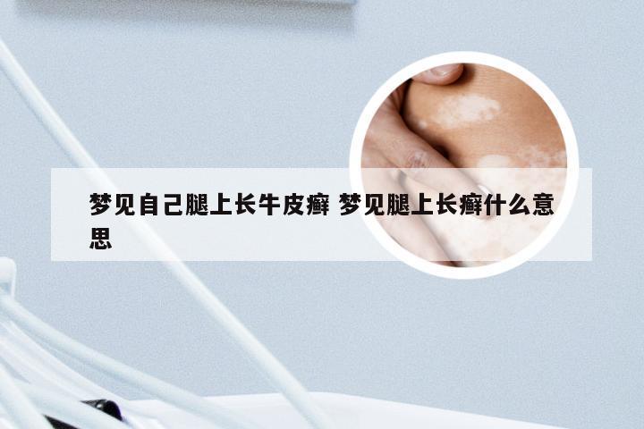 梦见自己腿上长牛皮癣 梦见腿上长癣什么意思