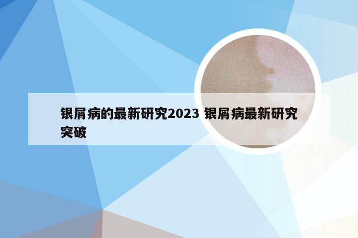 银屑病的最新研究2023 银屑病最新研究突破