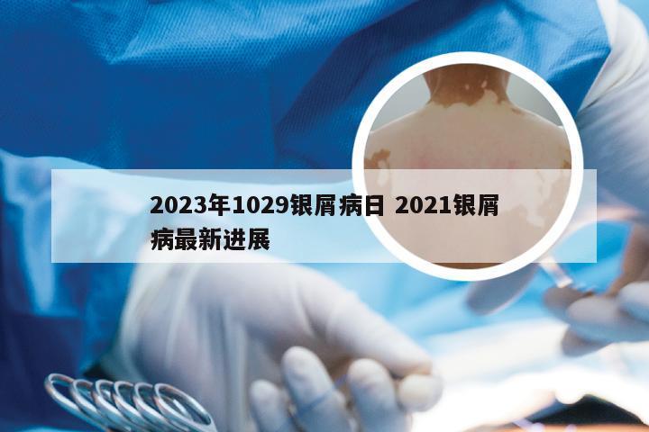 2023年1029银屑病日 2021银屑病最新进展