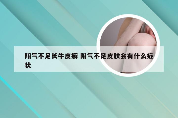 阳气不足长牛皮癣 阳气不足皮肤会有什么症状