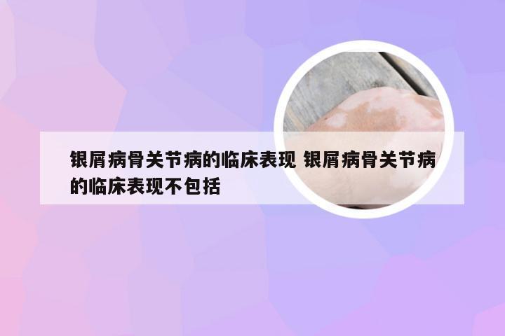 银屑病骨关节病的临床表现 银屑病骨关节病的临床表现不包括