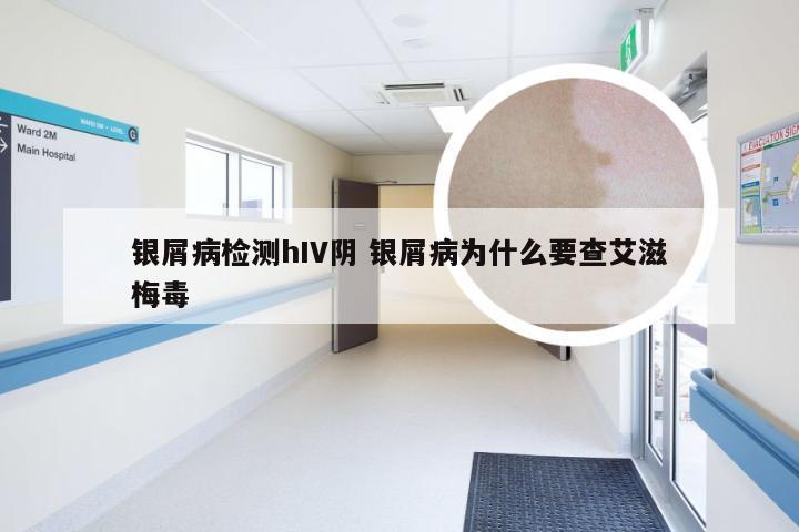 银屑病检测hIV阴 银屑病为什么要查艾滋梅毒