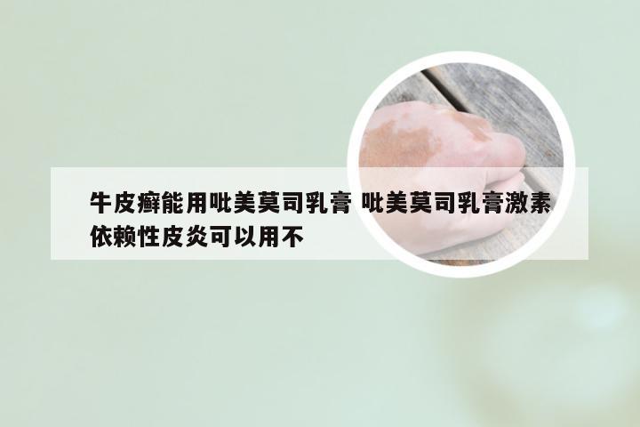 牛皮癣能用吡美莫司乳膏 吡美莫司乳膏激素依赖性皮炎可以用不