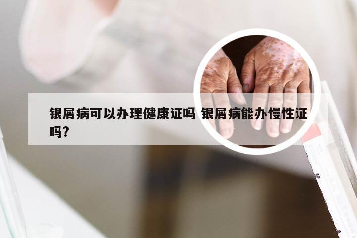 银屑病可以办理健康证吗 银屑病能办慢性证吗?