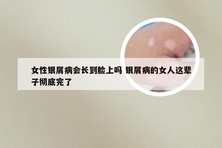 女性银屑病会长到脸上吗 银屑病的女人这辈子彻底完了