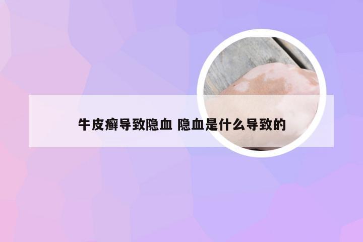 牛皮癣导致隐血 隐血是什么导致的