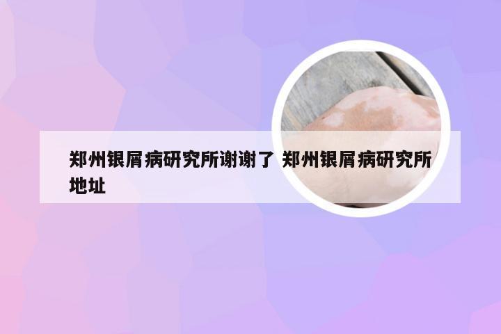 郑州银屑病研究所谢谢了 郑州银屑病研究所地址