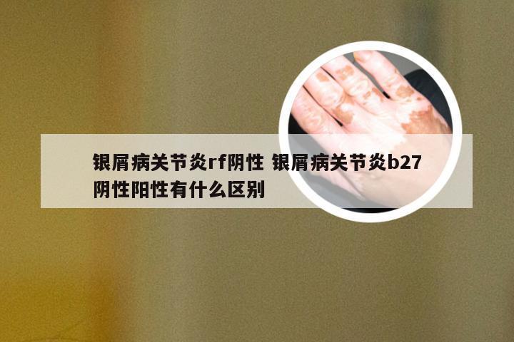 银屑病关节炎rf阴性 银屑病关节炎b27阴性阳性有什么区别