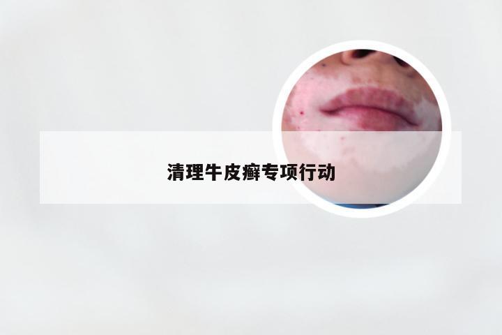 清理牛皮癣专项行动