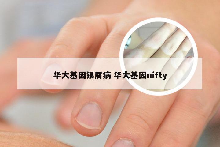 华大基因银屑病 华大基因nifty