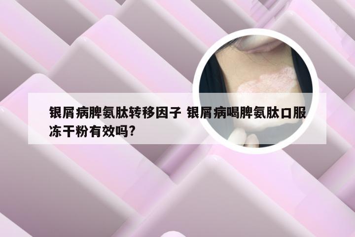 银屑病脾氨肽转移因子 银屑病喝脾氨肽口服冻干粉有效吗?