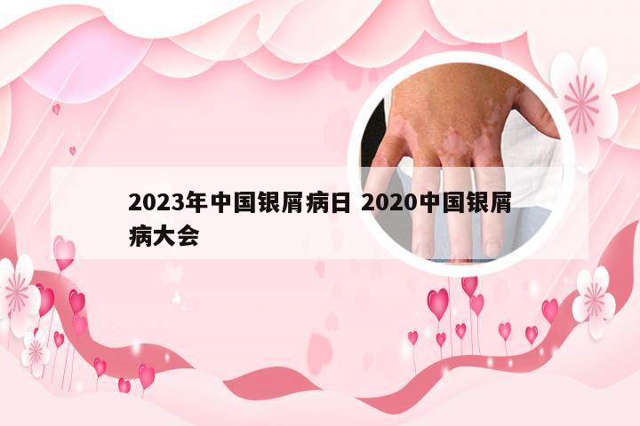 2023年中国银屑病日 2020中国银屑病大会