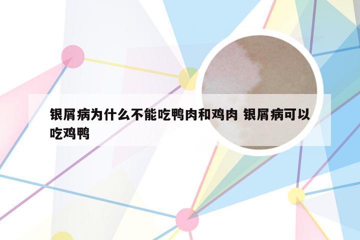 银屑病为什么不能吃鸭肉和鸡肉 银屑病可以吃鸡鸭