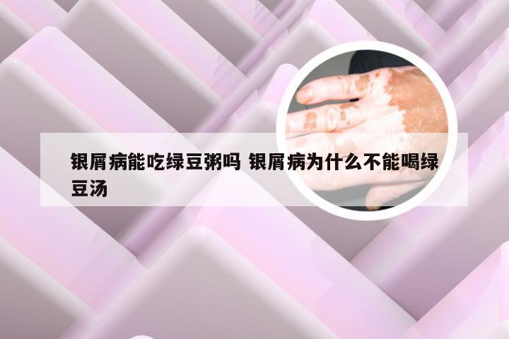 银屑病能吃绿豆粥吗 银屑病为什么不能喝绿豆汤