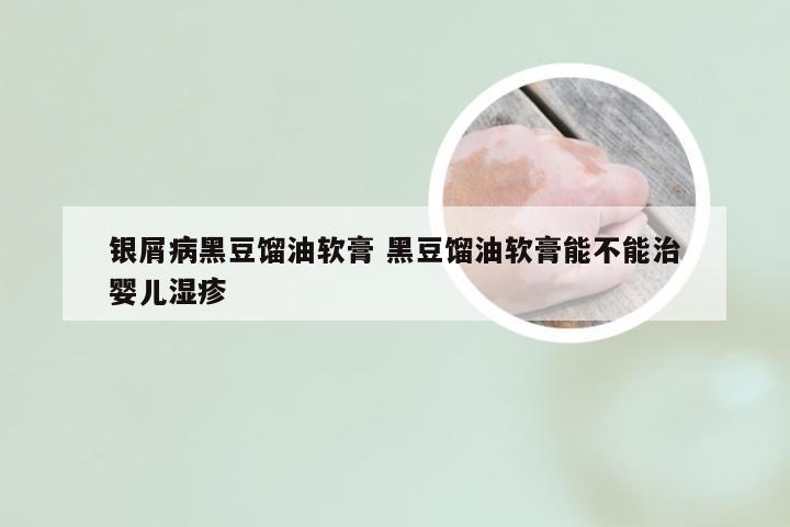 银屑病黑豆馏油软膏 黑豆馏油软膏能不能治婴儿湿疹