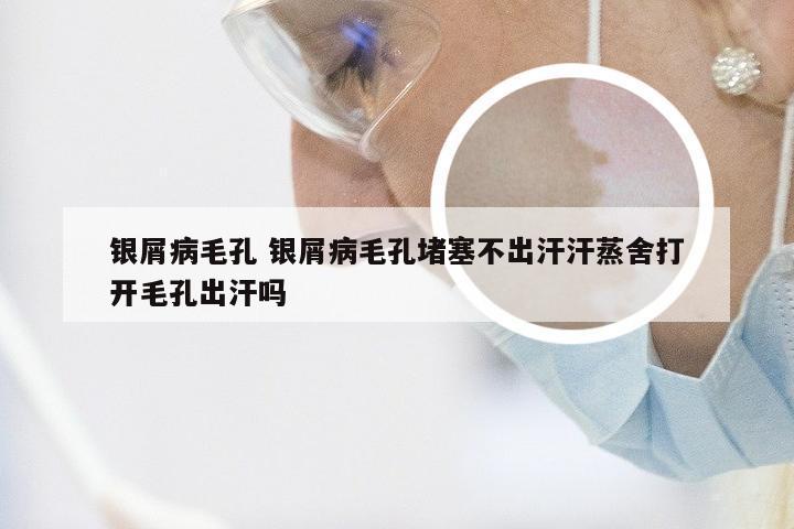 银屑病毛孔 银屑病毛孔堵塞不出汗汗蒸舍打开毛孔出汗吗