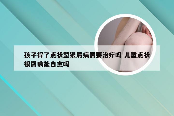 孩子得了点状型银屑病需要治疗吗 儿童点状银屑病能自愈吗